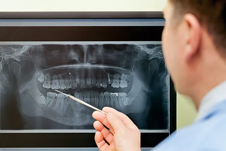 Dentist looking at jaw x-ray